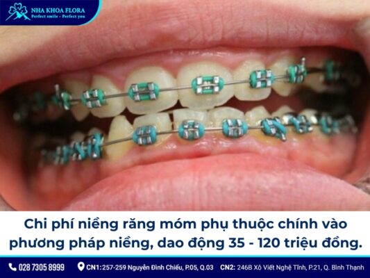 niềng răng móm - ảnh 7