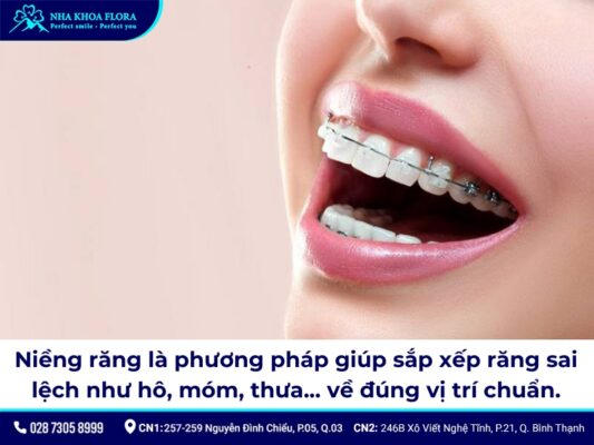 niềng răng người lớn - ảnh 1