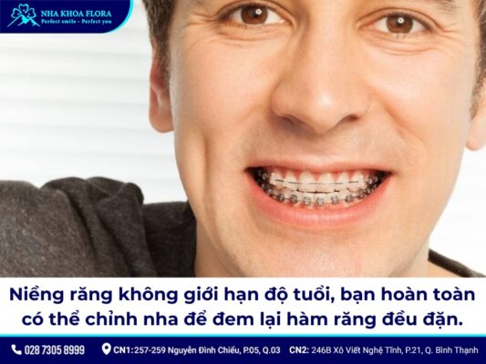 niềng răng người lớn - ảnh 2