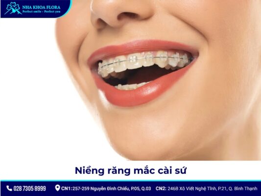 niềng răng người lớn - ảnh 6