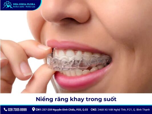 niềng răng người lớn - ảnh 7