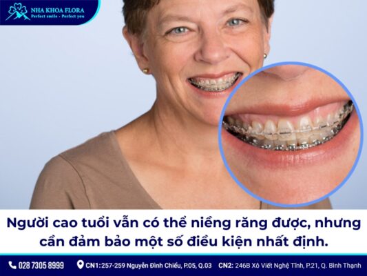 niềng răng người lớn - ảnh 8
