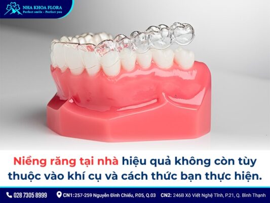 niềng răng tại nhà - ảnh 3