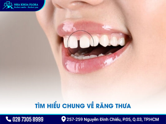 Niềng răng thưa 1 hàm giá bao nhiêu - ảnh 1
