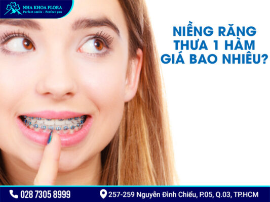 Niềng răng thưa 1 hàm giá bao nhiêu - ảnh 4