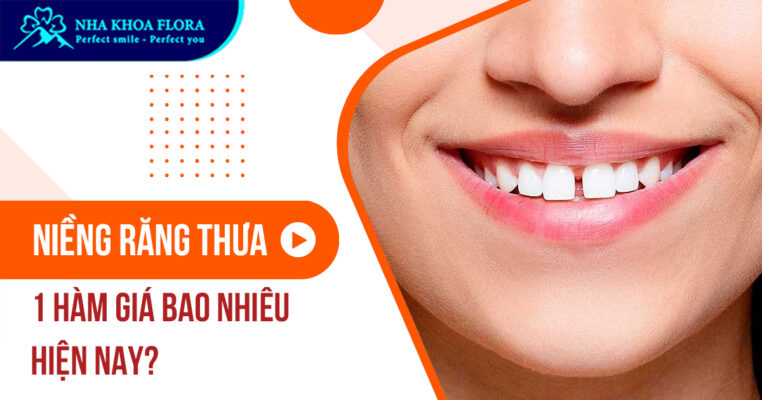 Niềng răng thưa 1 hàm giá bao nhiêu