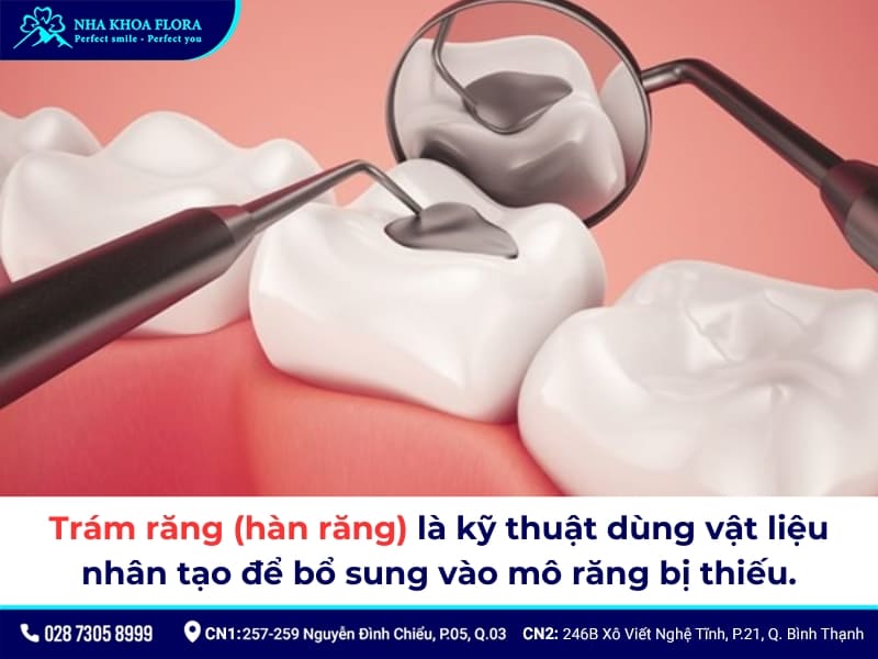 răng sứ bị mẻ có trám được không