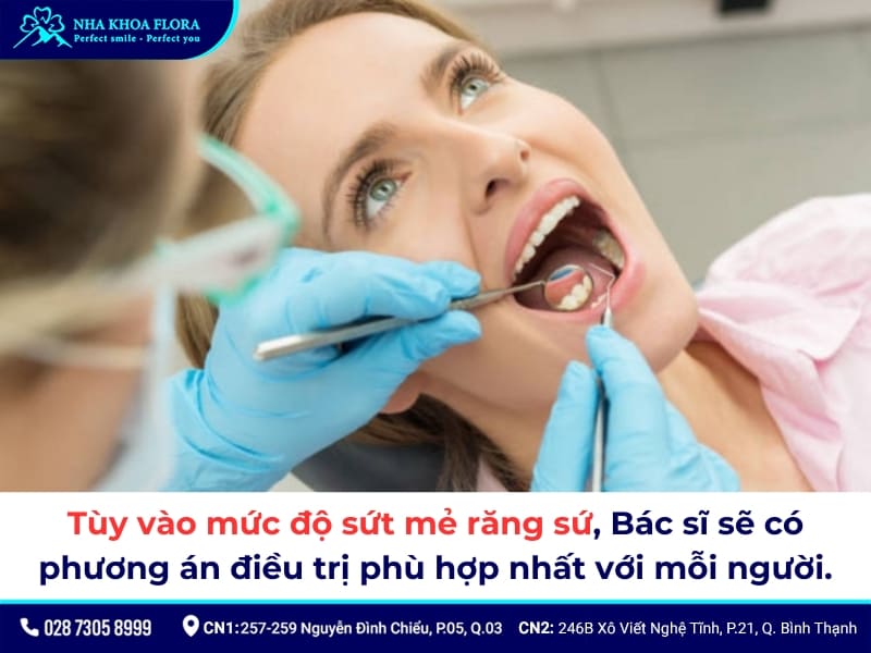 răng sứ bị mẻ có trám được không