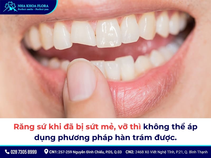 răng sứ bị mẻ có trám được không
