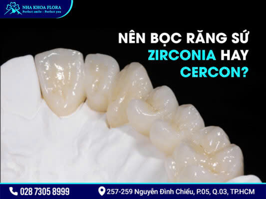 So sánh răng sứ Cercon và Zirconia - ảnh 4