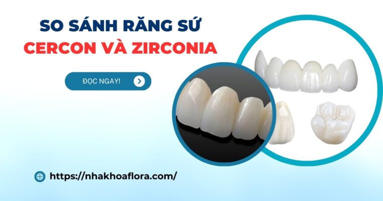 So sánh răng sứ Cercon và Zirconia
