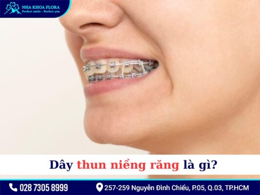 Thun niềng răng - ảnh 1