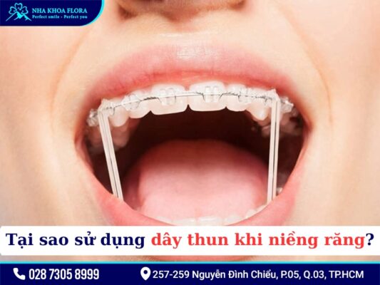 Thun niềng răng - ảnh 2