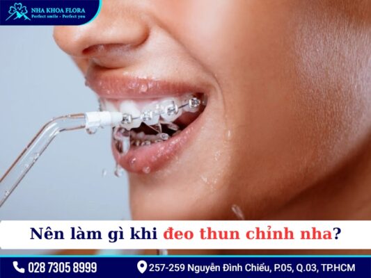 Thun niềng răng - ảnh 3