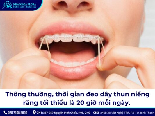 Thun niềng răng - ảnh 4