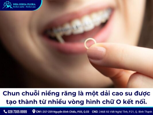 Thun niềng răng - ảnh 5