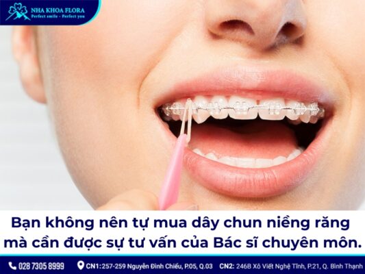 Thun niềng răng - ảnh 7