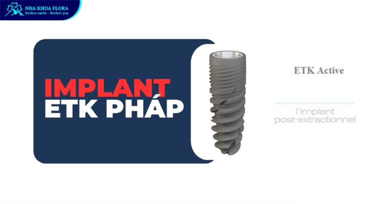 etk implant Pháp