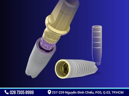 Implant Đức - ảnh 2