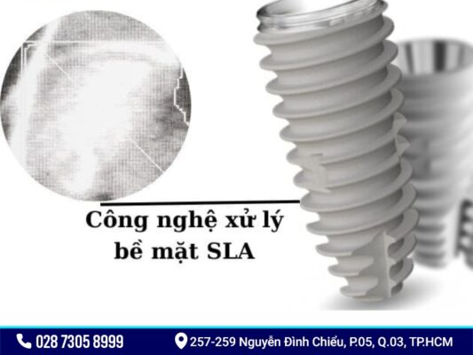 Implant Neobiotech - ảnh 3