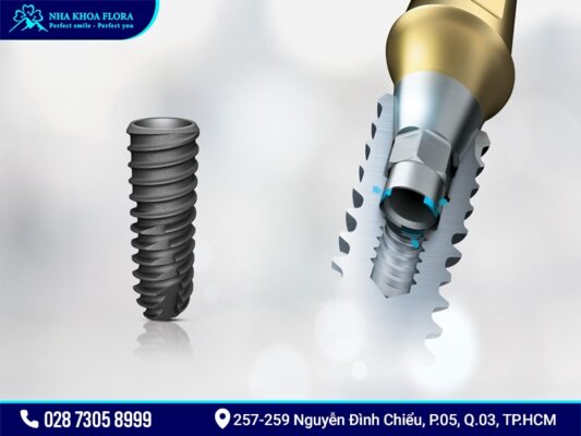Osstem-implant - ảnh 1