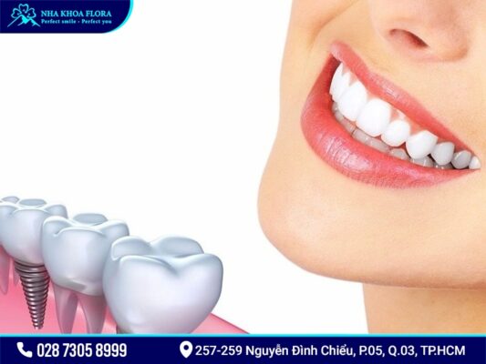 Osstem-implant - ảnh 4