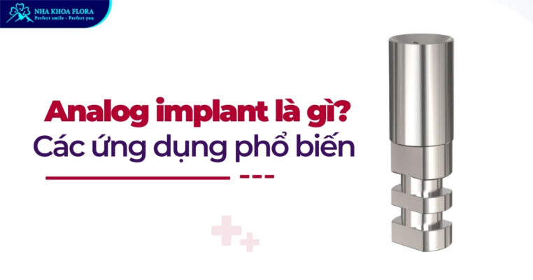Analogn Implant là gì?