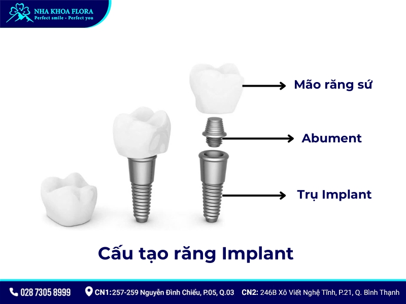 cấu tạo implant