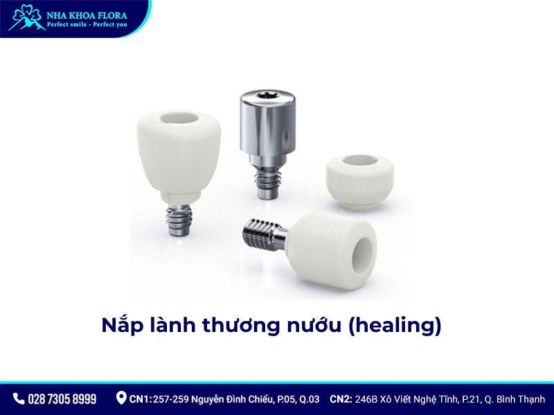 cấu tạo implant