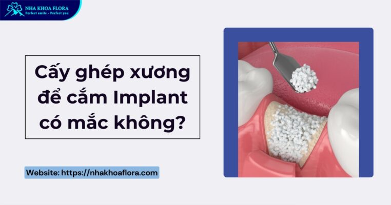 Cấy ghép xương để cắm Implant có mắc không?