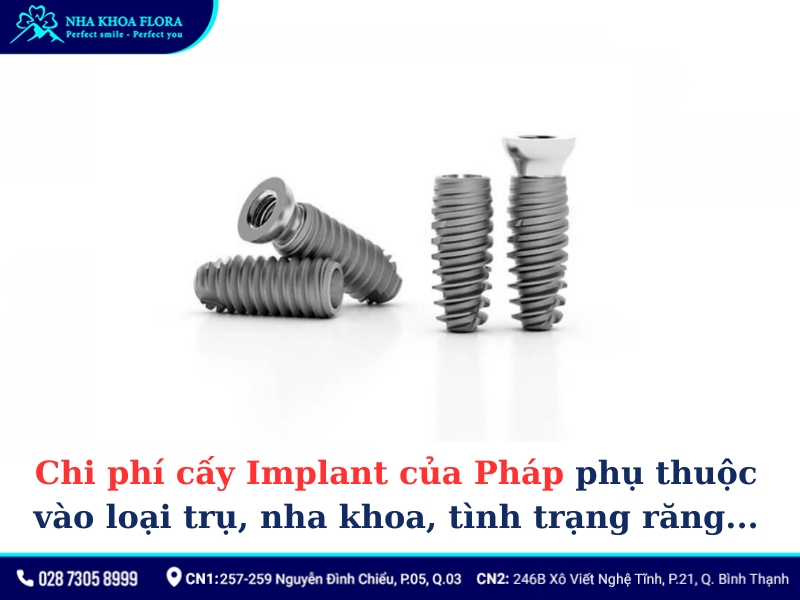 implant của pháp