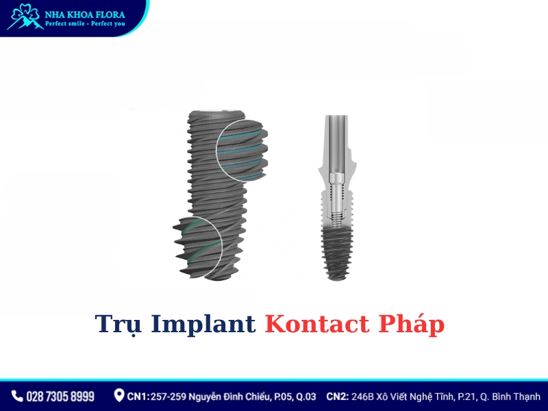 implant của pháp