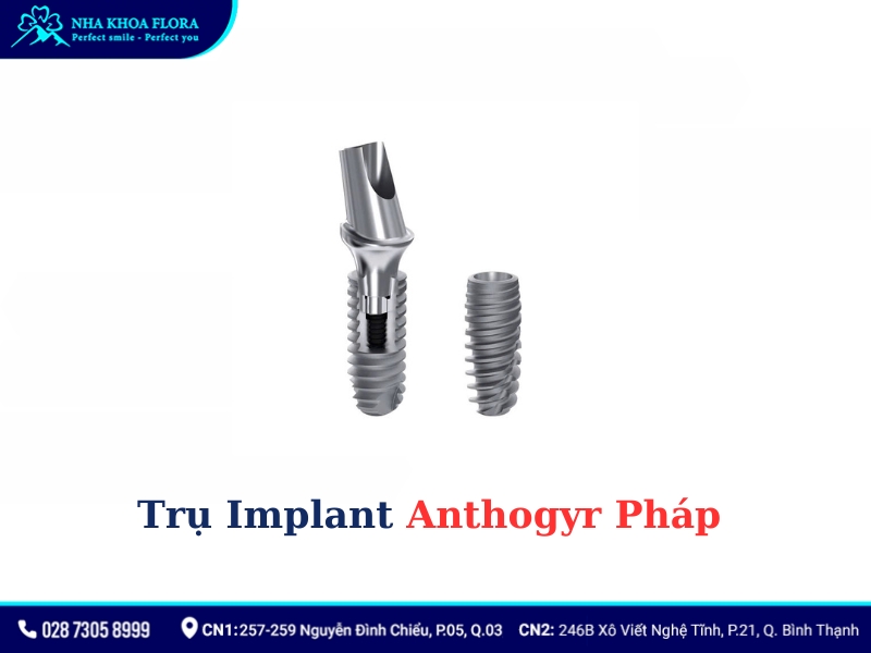 implant của pháp