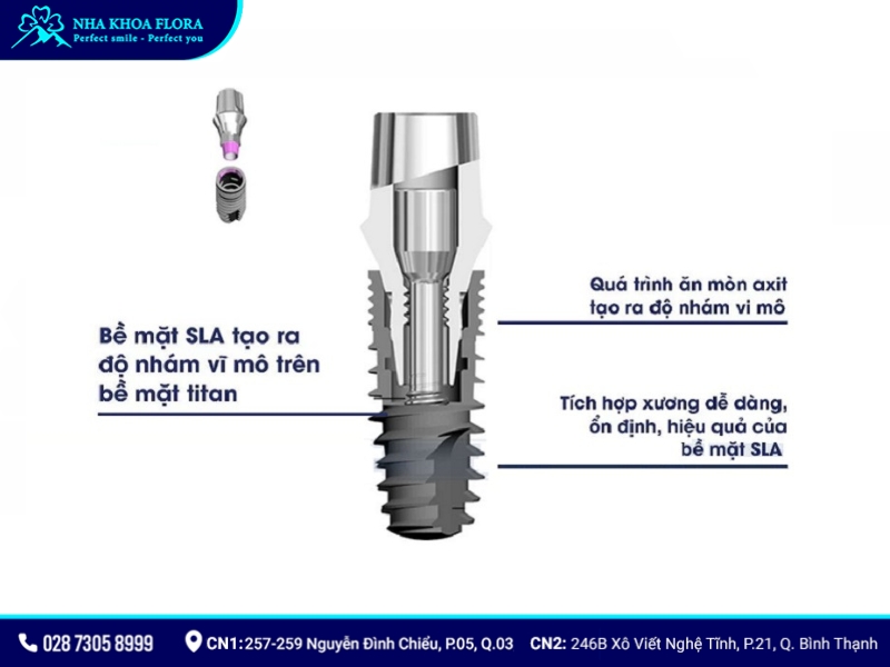 implant của pháp