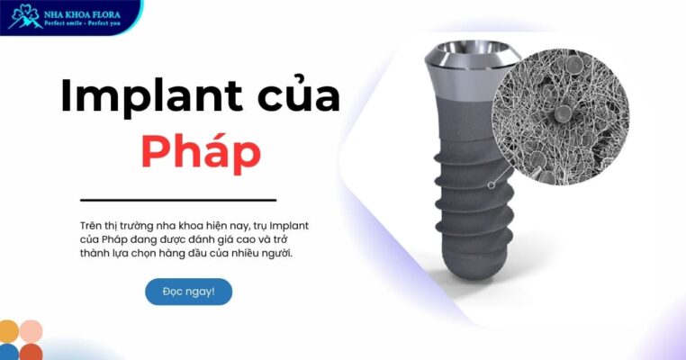 implant của pháp