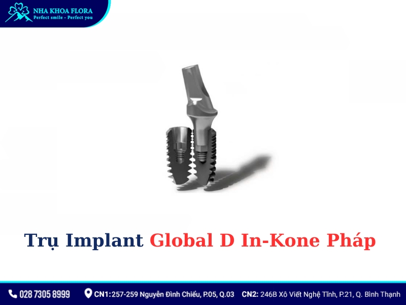 implant của pháp