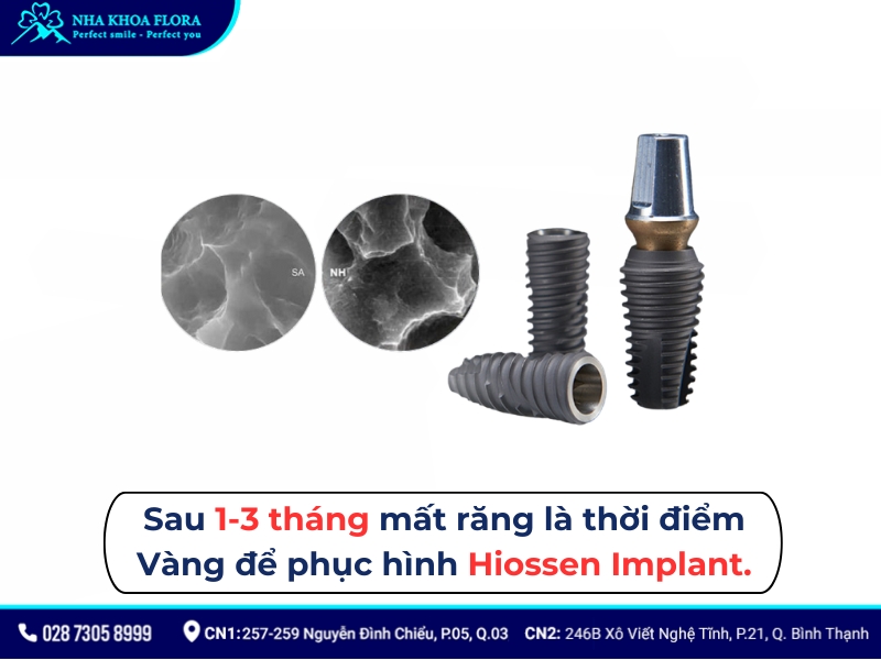 implant hiossen