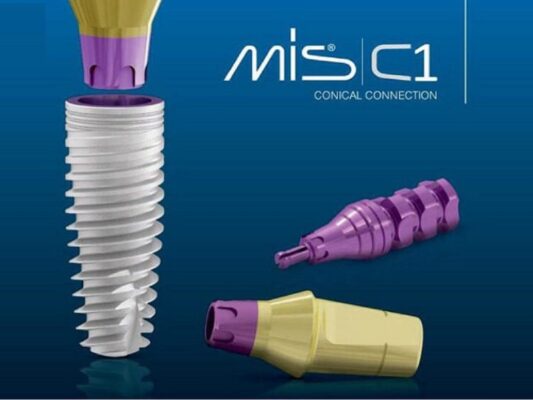 Implant Mis - ảnh 1