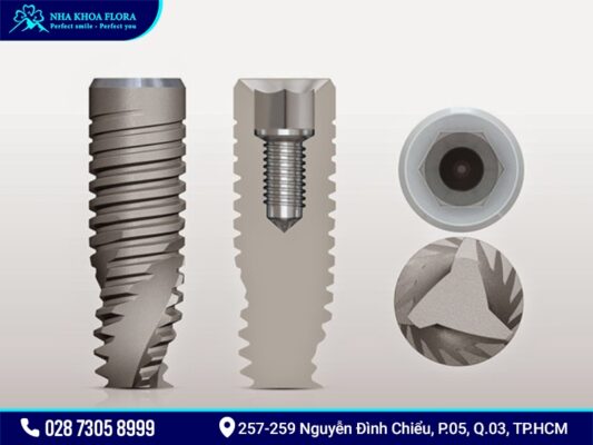 Implant Mis - ảnh 2