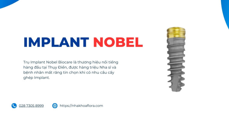 implant nobel