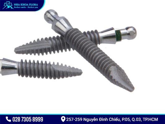 Mini Implant giá bao nhiêu? - ảnh 3