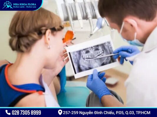 Mini Implant giá bao nhiêu? - ảnh 4