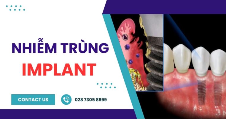 nhiễm trùng implant