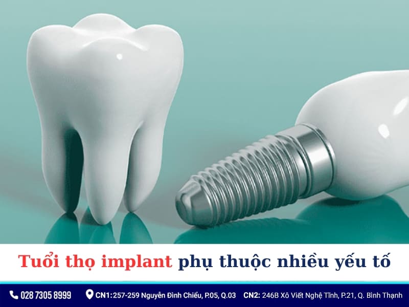 Tuổi thọ implant phụ thuộc nhiều yếu tố