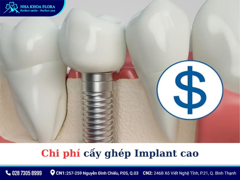 Chi phí cấy ghép Implant cao