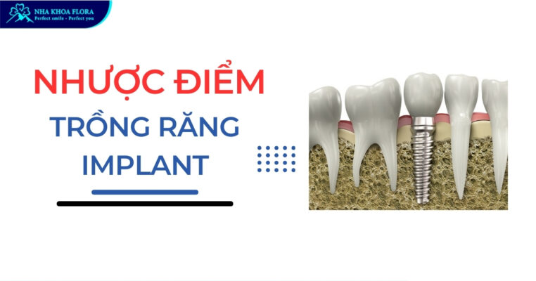 Nhược điểm của trồng răng Implant