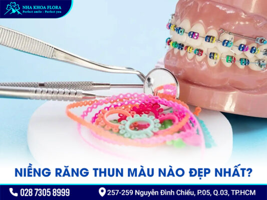 Niềng răng thun màu - ảnh 1