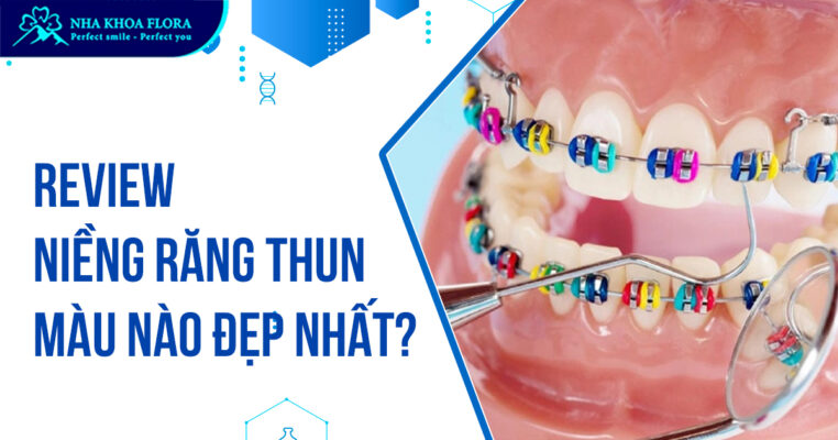 Niềng răng thun màu
