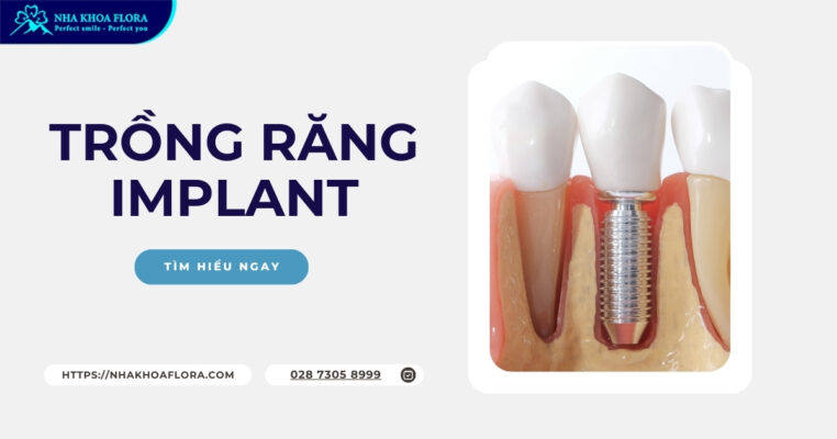 Trồng răng Implant