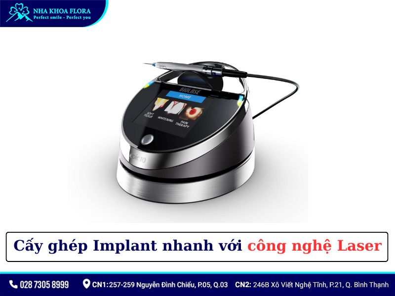 công nghệ laser tại nha khoa flora